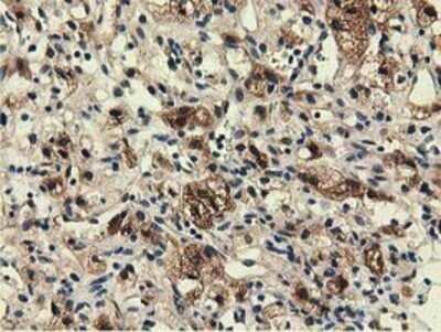 Immunohistochemistry: EPHX2 Antibody (OTI1A6) - Azide and BSA Free [NBP2-70648]