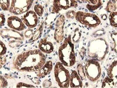 Immunohistochemistry: EPHX2 Antibody (OTI1A6) - Azide and BSA Free [NBP2-70648]