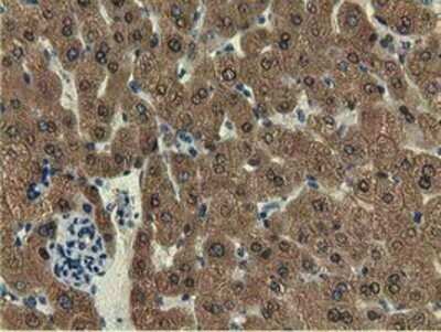 Immunohistochemistry: EPHX2 Antibody (OTI1A6) - Azide and BSA Free [NBP2-70648]