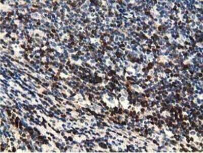 Immunohistochemistry: EPHX2 Antibody (OTI1A6) - Azide and BSA Free [NBP2-70648]