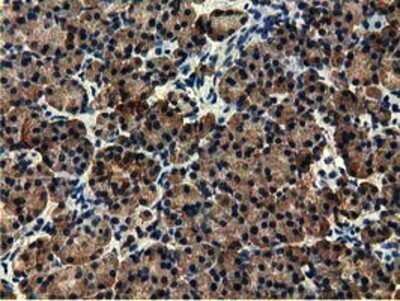 Immunohistochemistry: EPHX2 Antibody (OTI1A6) - Azide and BSA Free [NBP2-70648]