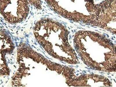 Immunohistochemistry: EPHX2 Antibody (OTI1A6) - Azide and BSA Free [NBP2-70648]