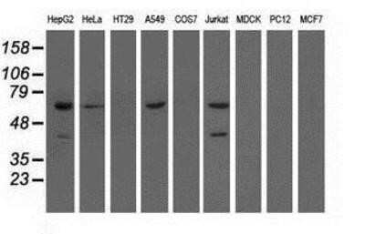 Western Blot: EPHX2 Antibody (OTI1A6)Azide and BSA Free [NBP2-70648]