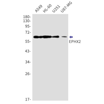 Western Blot: EPHX2 Antibody (S04-2F6) [NBP3-19986]