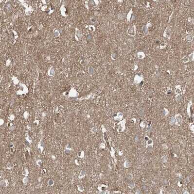 Immunohistochemistry-Paraffin: EPHX4 Antibody [NBP1-89307]