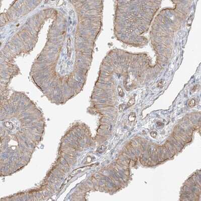 Immunohistochemistry-Paraffin: EPHX4 Antibody [NBP1-89307]