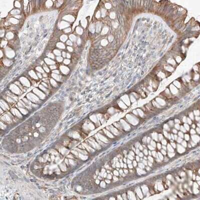 Immunohistochemistry-Paraffin: EPHX4 Antibody [NBP1-89307]