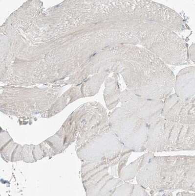 Immunohistochemistry-Paraffin: EPHX4 Antibody [NBP1-89307]