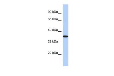 Western Blot: EPHX4 Antibody [NBP2-84860]