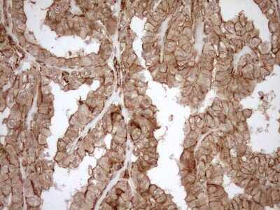 Immunohistochemistry: EPLIN Antibody (OTI1A3) [NBP2-45652]