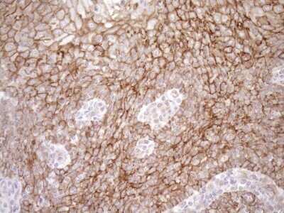 Immunohistochemistry: EPLIN Antibody (OTI1A3) [NBP2-45652]