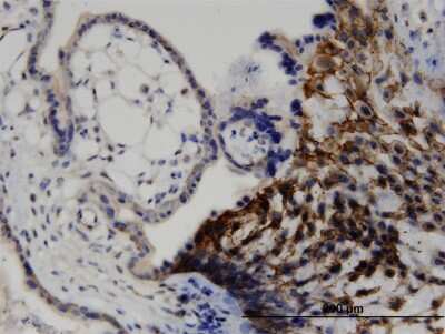 Immunohistochemistry-Paraffin: EPLIN Antibody (1B7) [H00051474-M06]