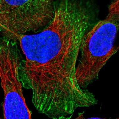 Immunocytochemistry/ Immunofluorescence: EPLIN Antibody [NBP2-38673]