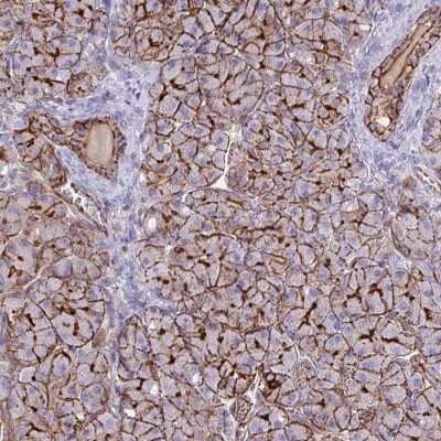 Immunohistochemistry-Paraffin: EPLIN Antibody [NBP2-38673]