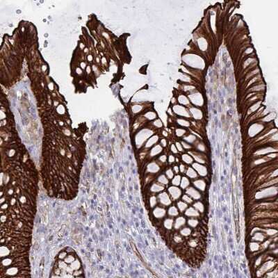 Immunohistochemistry-Paraffin: EPLIN Antibody [NBP2-38673]