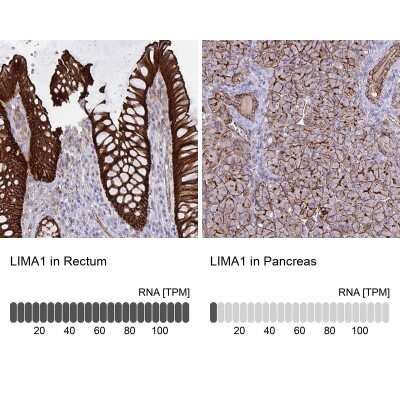 Immunohistochemistry-Paraffin: EPLIN Antibody [NBP2-38673]