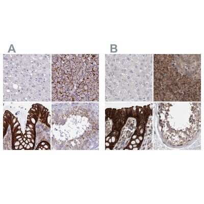 Immunohistochemistry-Paraffin: EPLIN Antibody [NBP2-38673]