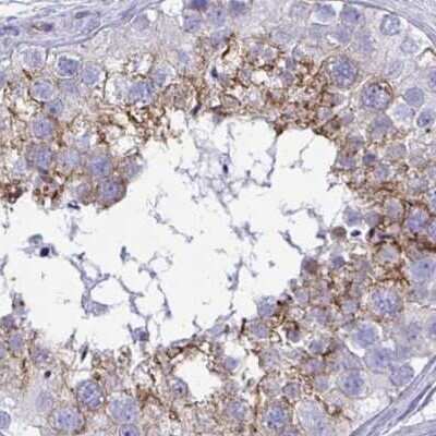 Immunohistochemistry-Paraffin: EPLIN Antibody [NBP2-38673]