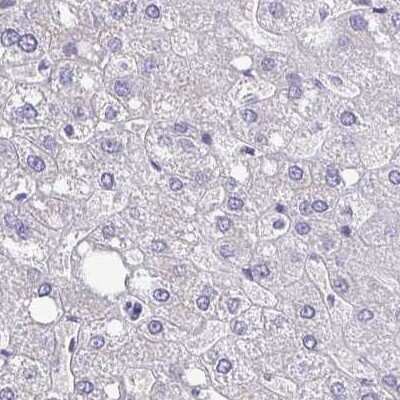 Immunohistochemistry-Paraffin: EPLIN Antibody [NBP2-38673]