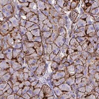 Immunohistochemistry-Paraffin: EPLIN Antibody [NBP2-38673]