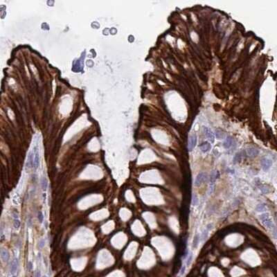 Immunohistochemistry-Paraffin: EPLIN Antibody [NBP2-38673]