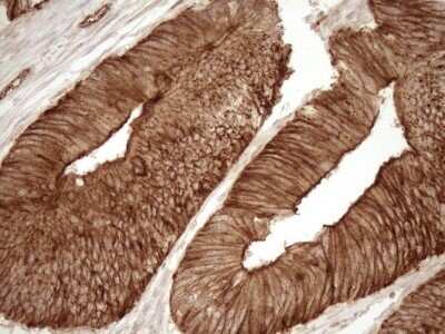 Immunohistochemistry: EPLIN Antibody (OTI1A3) - Azide and BSA Free [NBP2-71932]