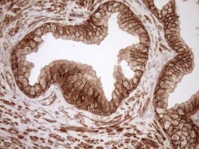 Immunohistochemistry: EPLIN Antibody (OTI1A3) - Azide and BSA Free [NBP2-71932]
