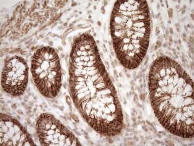 Immunohistochemistry: EPLIN Antibody (OTI1A3) - Azide and BSA Free [NBP2-71932]
