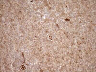 Immunohistochemistry: EPLIN Antibody (OTI1A3) - Azide and BSA Free [NBP2-71932]