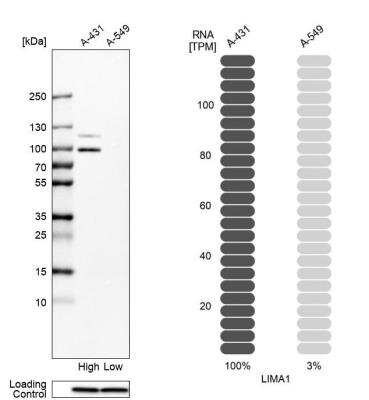 Western Blot: EPLIN Antibody [NBP2-38673]