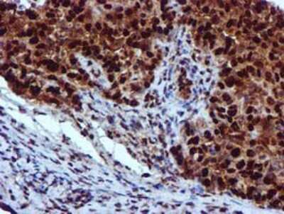 Immunohistochemistry-Paraffin: EPM2AIP1 Antibody (OTI2A2) [NBP2-03092]
