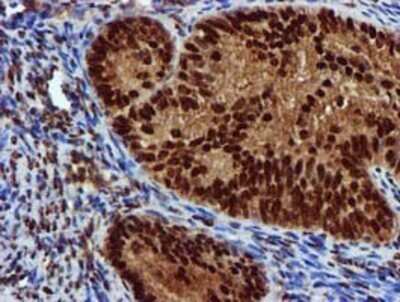 Immunohistochemistry: EPM2AIP1 Antibody (OTI2A2) - Azide and BSA Free [NBP2-71497]
