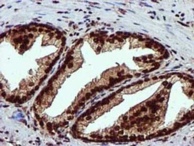 Immunohistochemistry: EPM2AIP1 Antibody (OTI2A2) - Azide and BSA Free [NBP2-71497]