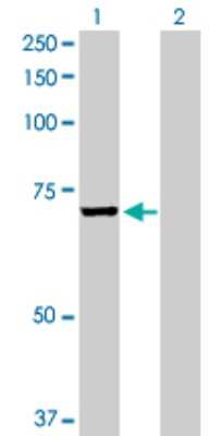 Western Blot: EPM2AIP1 Antibody [H00009852-D01P]