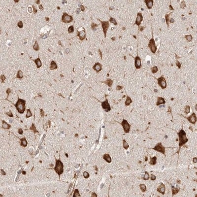 Immunohistochemistry-Paraffin: EPRS Antibody [NBP1-84929]