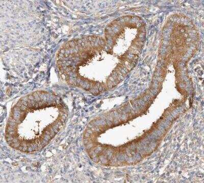 Immunohistochemistry-Paraffin: EPRS Antibody [NBP1-84929]