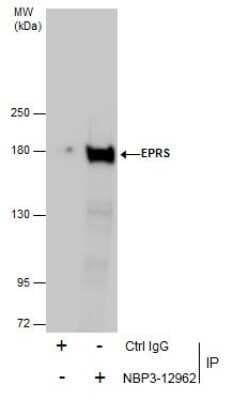Immunoprecipitation: EPRS Antibody [NBP3-12962]