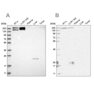 Western Blot: EPRS Antibody [NBP1-84930]