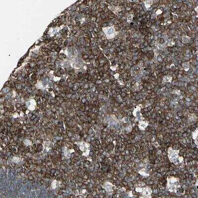 Immunohistochemistry-Paraffin: EPS15 Antibody [NBP1-89221]