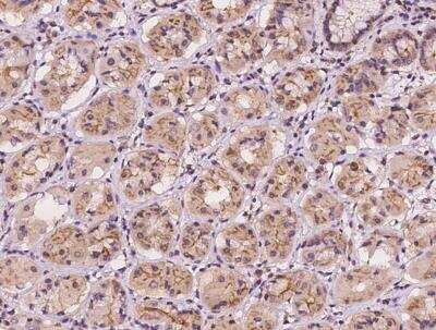 Immunohistochemistry-Paraffin: EPS15 Antibody [NBP3-12544]