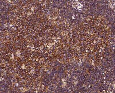 Immunohistochemistry-Paraffin: EPS15 Antibody [NBP3-12544]