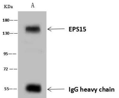 Immunoprecipitation: EPS15 Antibody [NBP3-12544]
