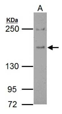 Western Blot: EPS15 Antibody [NBP2-16356]