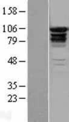 Western Blot: EPS15R Overexpression Lysate [NBL1-10302]