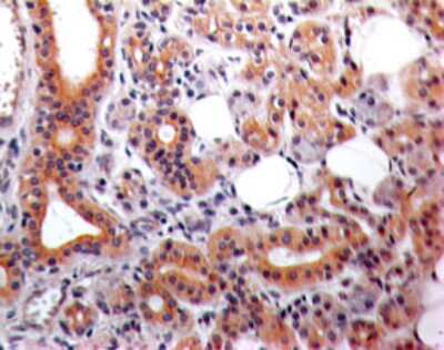 Immunohistochemistry-Paraffin: Eps8 Antibody (18F5B11) [NBP2-27344]