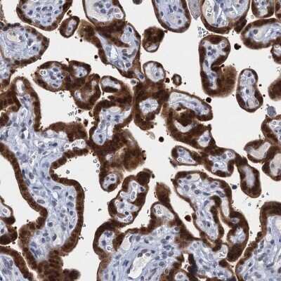 Immunohistochemistry: EPS8L1 Antibody [NBP2-32599]