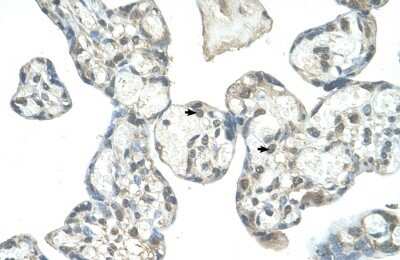 Immunohistochemistry-Paraffin: EPS8L1 Antibody [NBP1-56689]