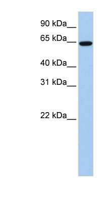 Western Blot: EPS8L1 Antibody [NBP1-56615]