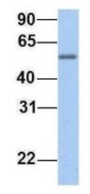 Western Blot: EPS8L1 Antibody [NBP1-56615]
