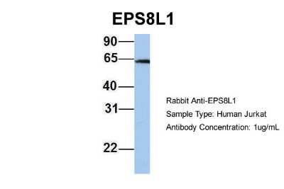 Western Blot: EPS8L1 Antibody [NBP1-56615]